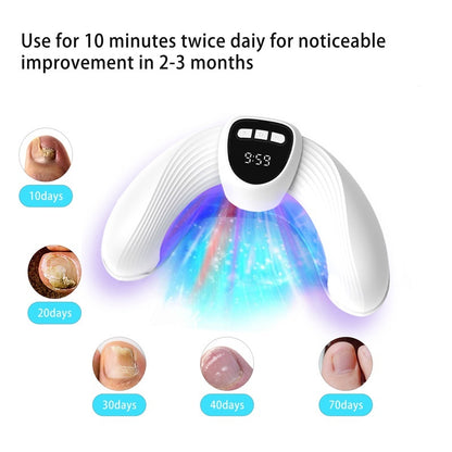 U-shaped Portable Home Nail Phototherapy Machine